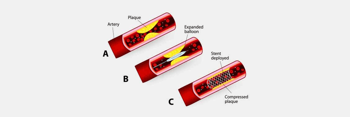 Medical Devices